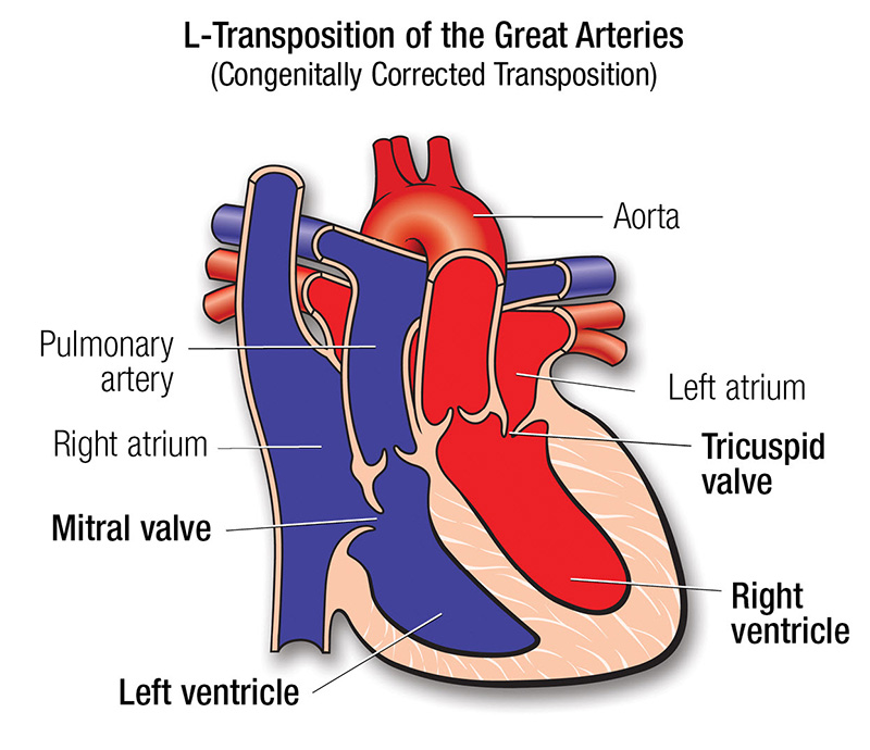 L-TGA diagram